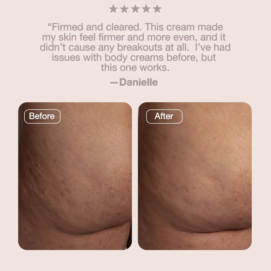 Buttface BBL Firming Cream — customer results and dermatologist-approved claim testimonial graphic