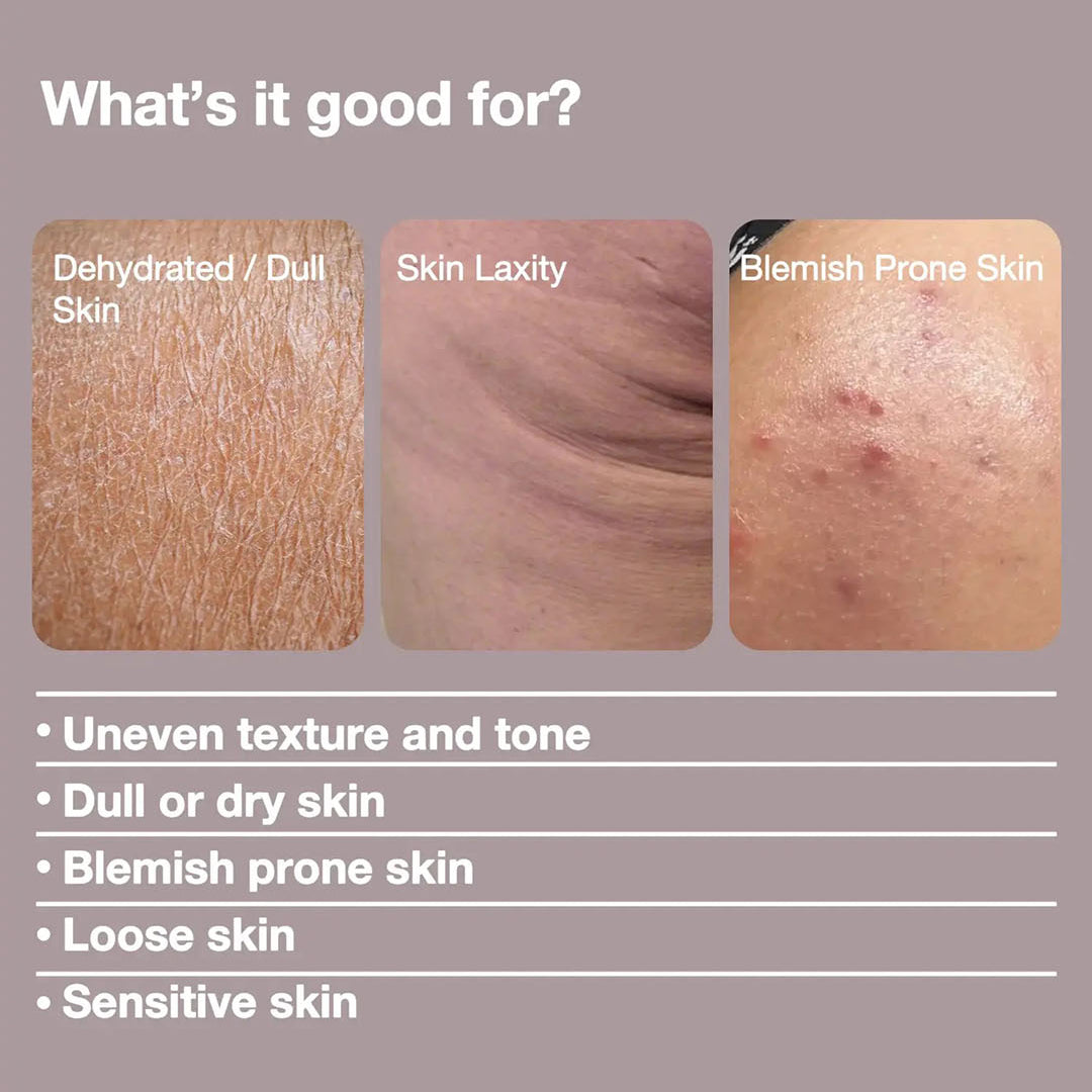 Buttface BBL Firming Cream — firming, plumping and lifting benefits visual explainer